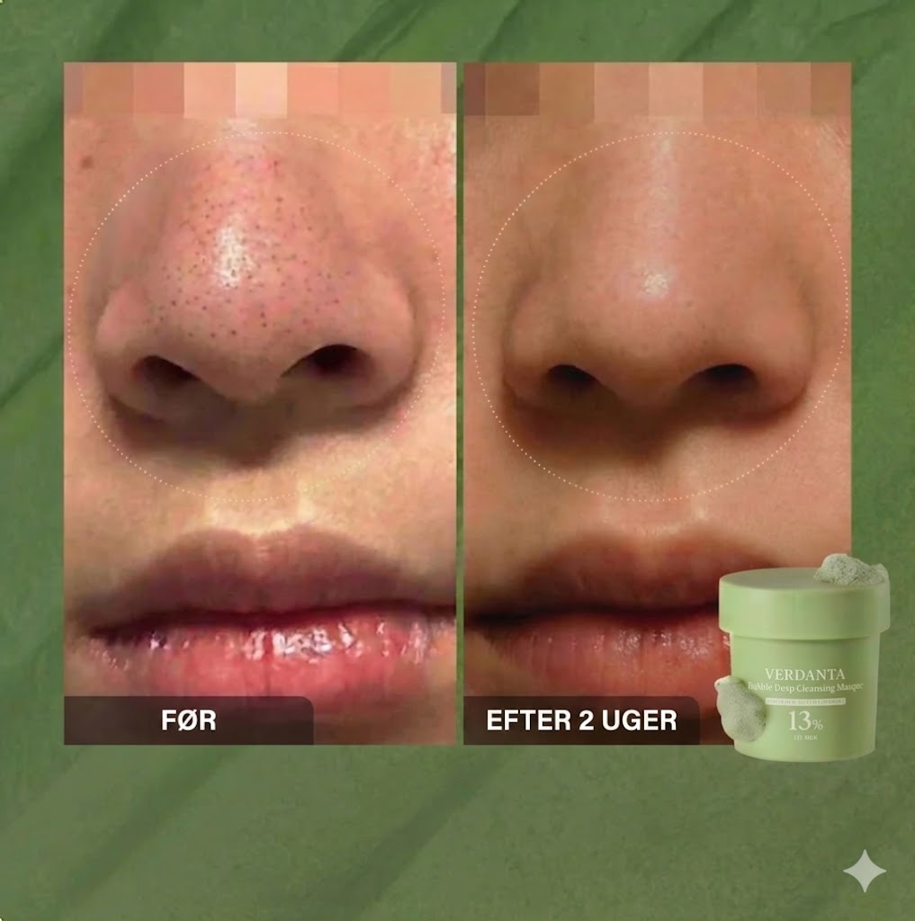 Verdanta| Holy Brasil Diepe Masker reinigt je poriën