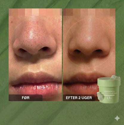 Verdanta| Holy Brasil Diepe Masker reinigt je poriën