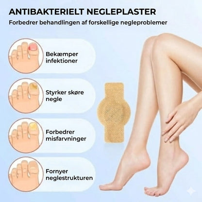 FungalPatch - Antibakterielt og svampedræbende plaster samt neglepleje-pakke