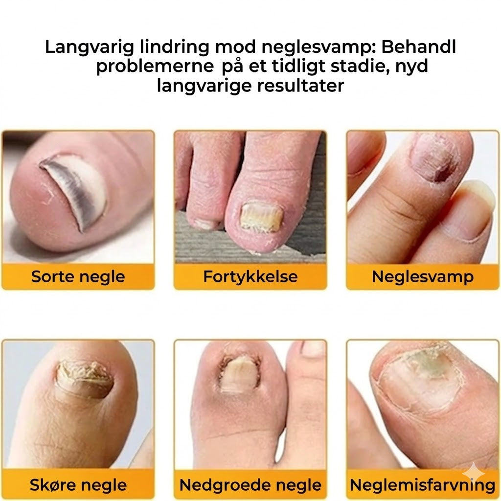 FungalPatch - Antibakterielt og svampedræbende plaster samt neglepleje-pakke