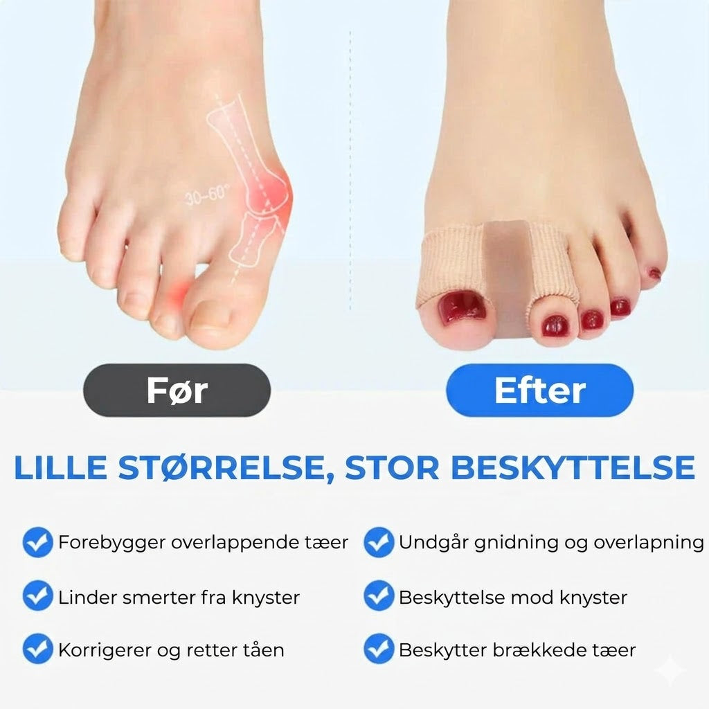Ergonomisk bordspreder - 2 stk.