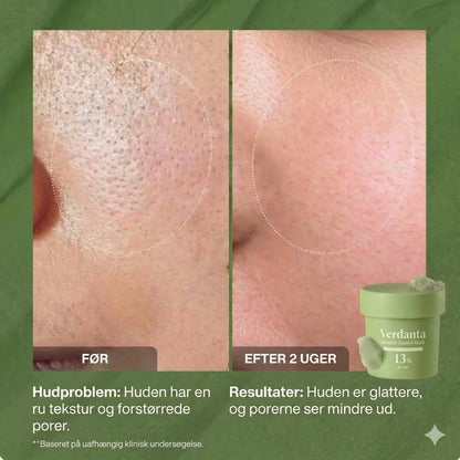 Verdanta| Holy Brasil Diepe Masker reinigt je poriën
